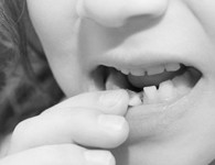 Удаление молочного зуба Томск Старо-Деповской улыбка стоматология томск 1905 года