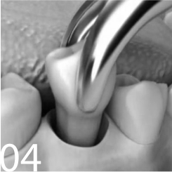 Удаление зуба Томск Шумихинский детская стоматология томск мюнниха 17 электронная регистратура