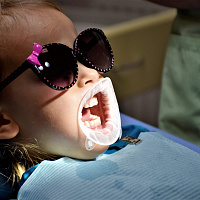 Акция “Чистка молочного прикуса + фторирование” 