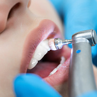 Гигиеническая чистка по «горящему окну» — скидка 10%